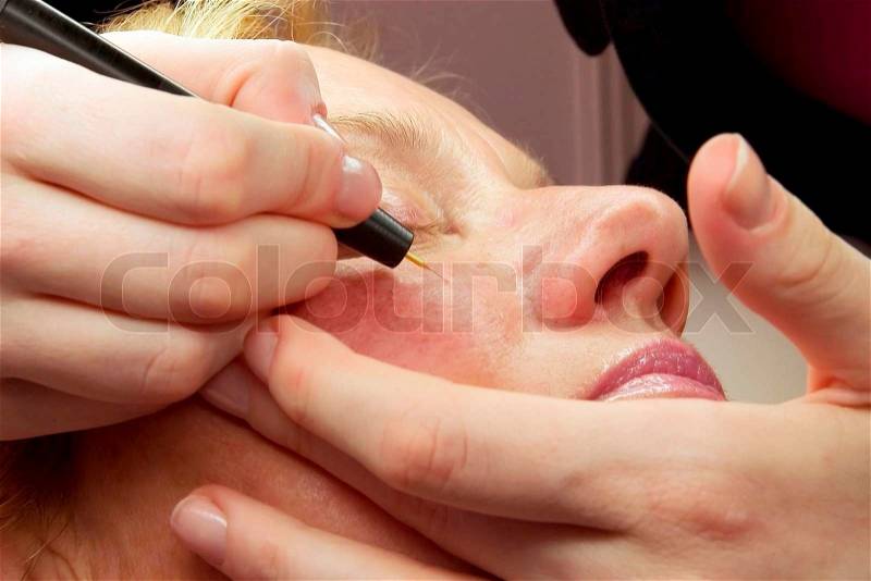 Therapyst healing capillary damage from old face, stock photo