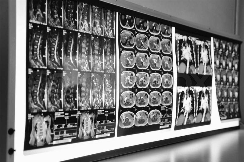 Medical background. Wall of MRI x-rays, stock photo
