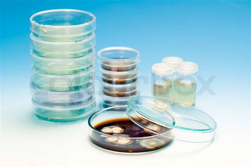 Petri dish with colonies of microorganisms, stock photo
