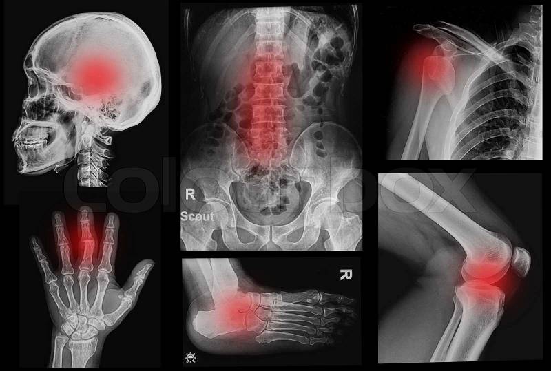 Collage x-rays image of human ,show body part of human, stock photo