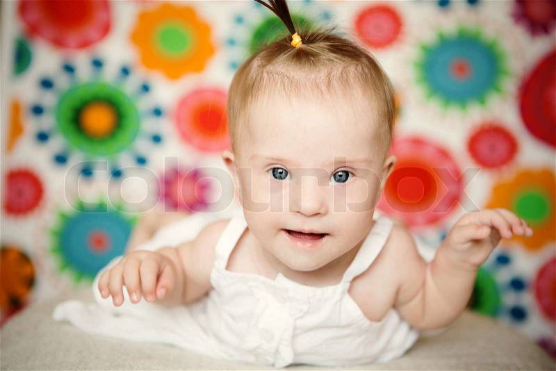 Little girl with Down syndrome, stock photo