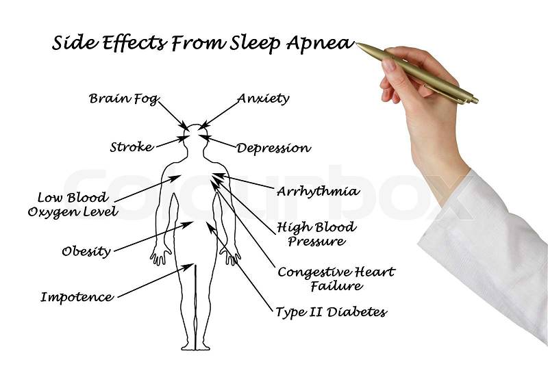 Sife Effects From Sleep Apnea , stock photo