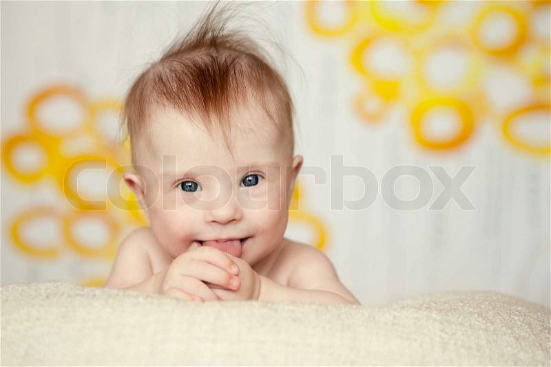 Cheerful little baby girl with Downs Syndrome, stock photo