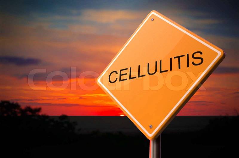 Cellulitis on Warning Road Sign on Sunset Sky Background, stock photo