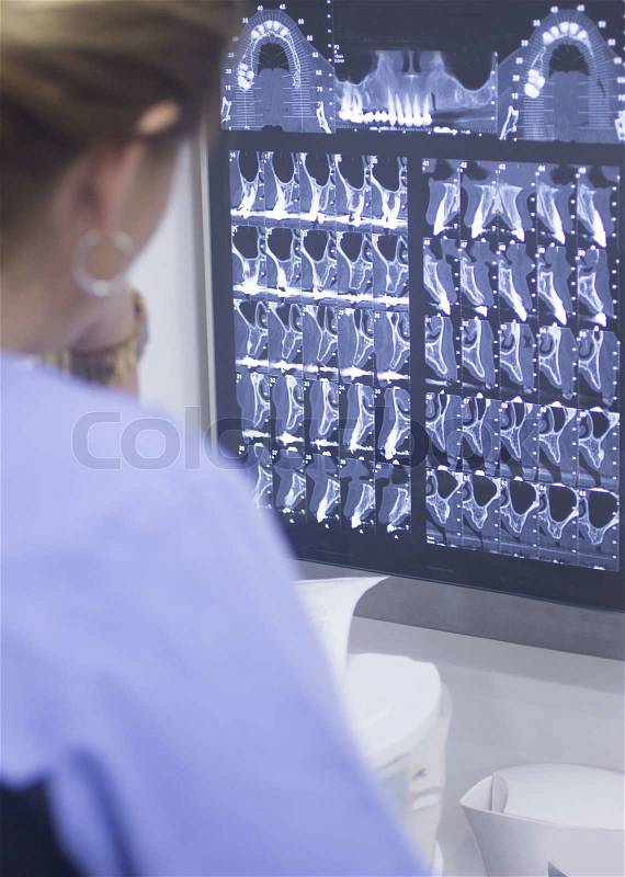 Dental xray scan on viewer in dentist´s office clinic, stock photo