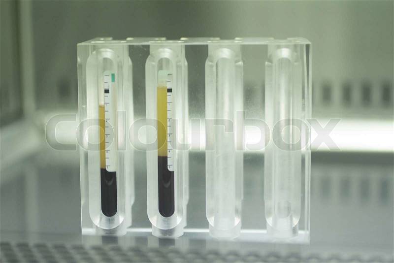 Medical laboratory preparation of human growth factors in hospital clinic for orthopedic surgery and Traumatology rehabilitation treatment with test tubes in sterile environment, stock photo
