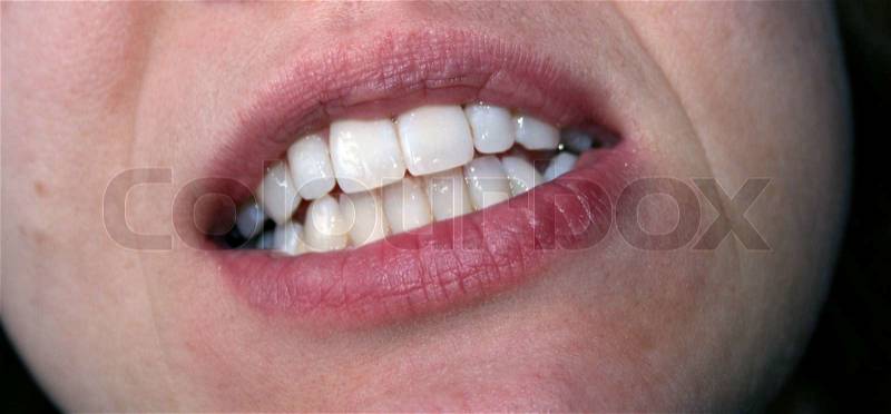 A woman with white teeth grinding, stock photo