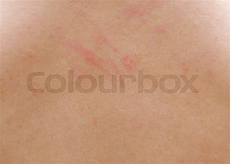 Close up view of human skin, stock photo