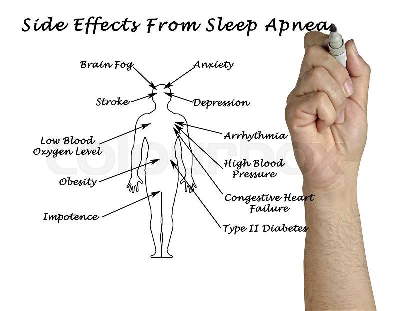 Side Effects From Sleep Apnea, stock photo