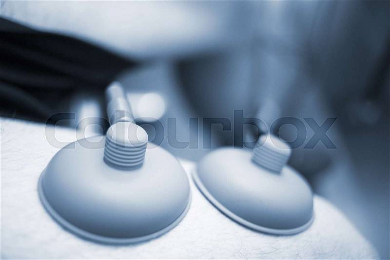 Electro stimulation used to treat pain, muscles injuries, strains and tension in hospital physiotherapy clinic. , stock photo