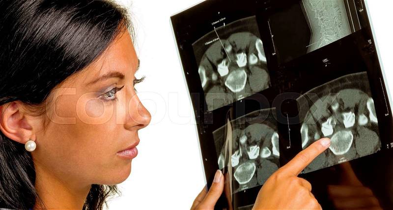 A doctor holding the x-ray image of a disc infiltration in hand, stock photo