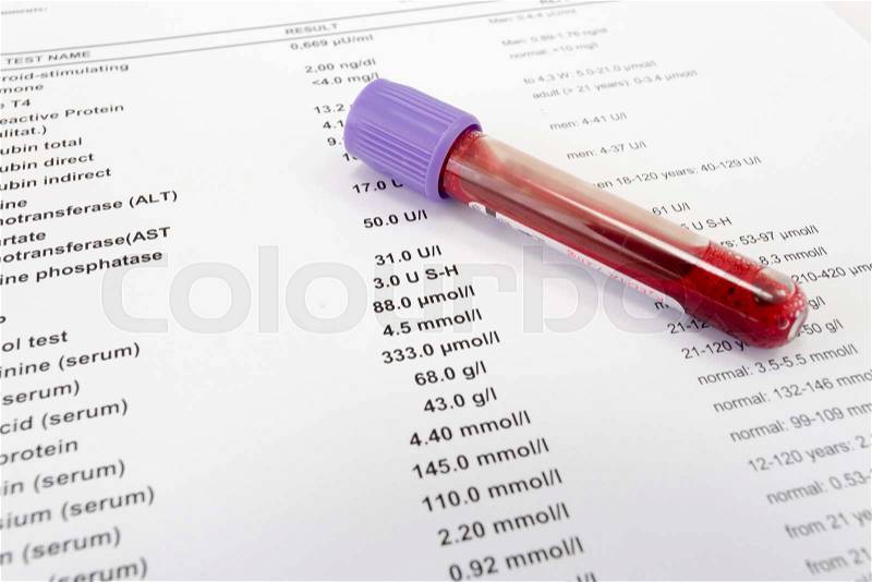 Red blood in test tube on white blank with results in colums. The results are written in English, stock photo