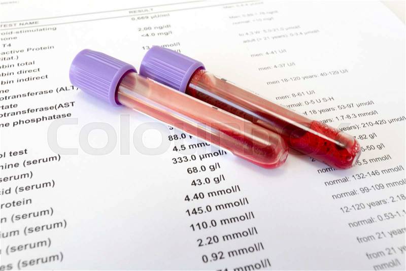 Red blood in test tubes on white blank with results in colums. The results are written in English, stock photo