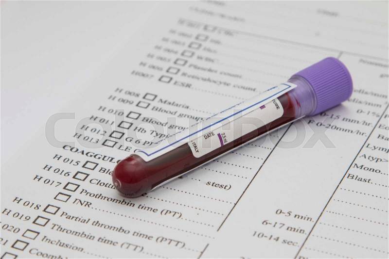 A bottle of blood sample on medical report , stock photo