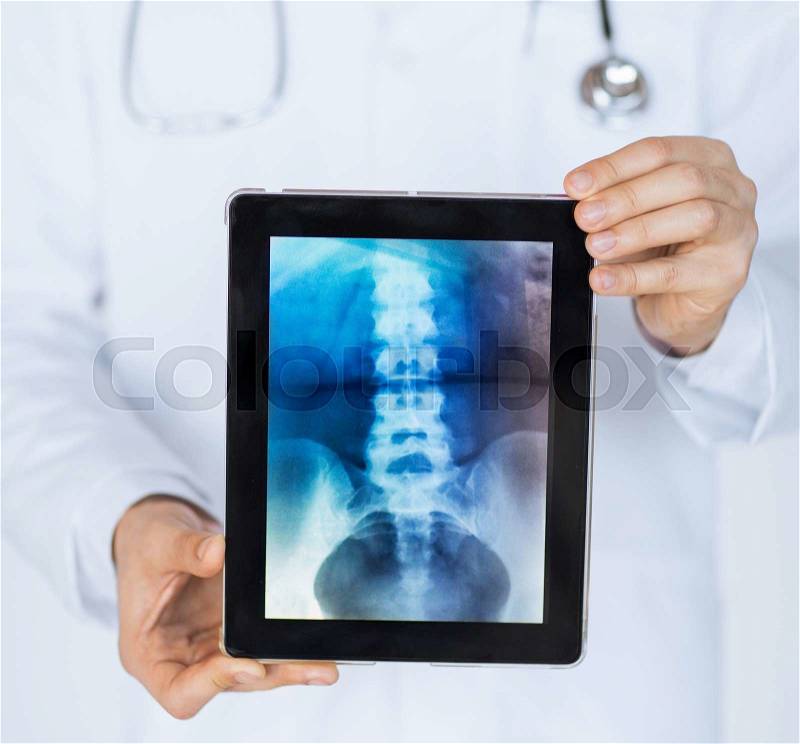 Close up of male doctor holding tablet pc with x-ray, stock photo