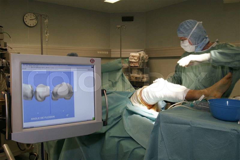 Scene of surgical operation of the knee under the assistance of a robot, stock photo