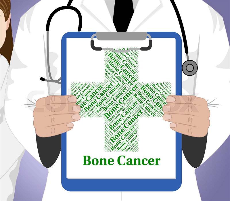 Bone Cancer Indicating Malignant Growth And Disorder, stock photo