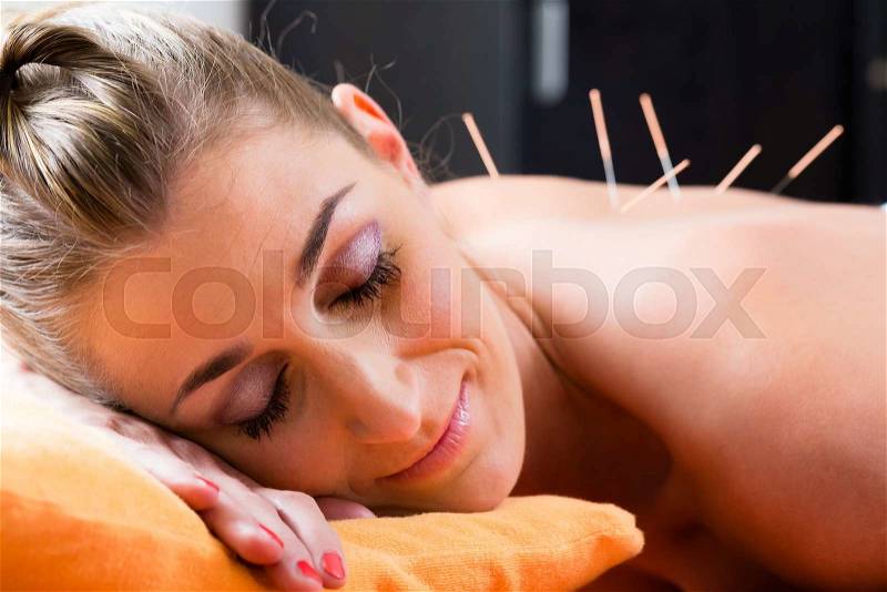 Woman at acupuncture session with needles in back having alternative therapy, stock photo