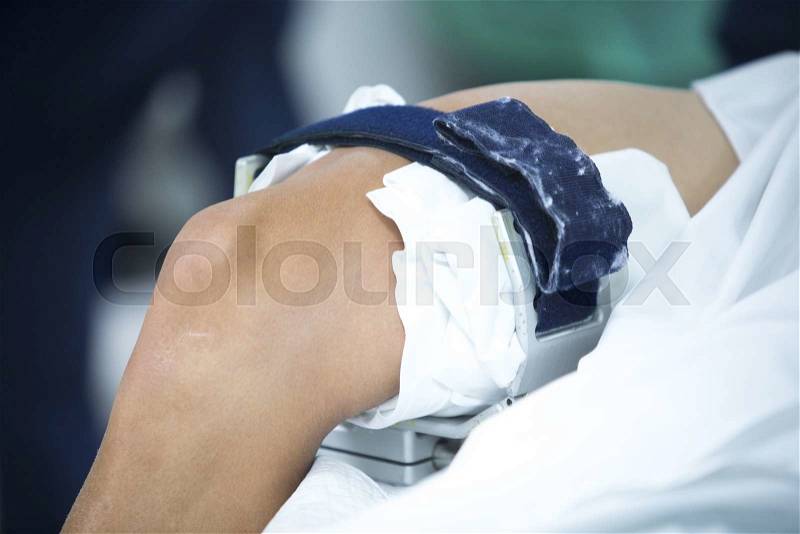 Traumatology orthopedic surgery hospital emergency operating room prepared for knee torn meniscus immobilised for arthroscopy operation photo, stock photo
