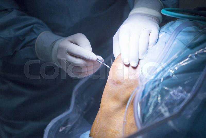 Traumatology orthopedic surgery hospital emergency operating room prepared for knee torn meniscus arthroscopy operation photo of drip fluids tube, stock photo