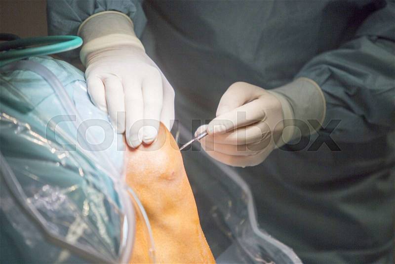 Traumatology orthopedic surgery hospital emergency operating room prepared for knee torn meniscus arthroscopy operation photo of drip fluids tube, stock photo