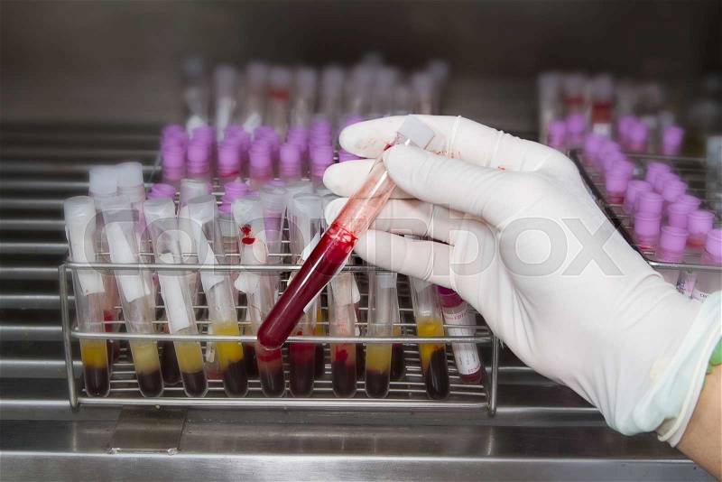 Lab technician holding blood tube test in blood bank background blood samples other patients , stock photo