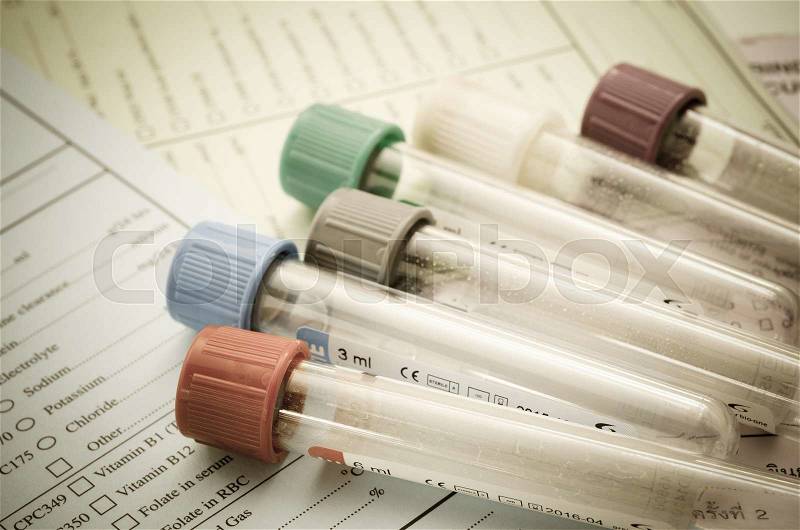 The old blood tubes for test on reqest form medical testing in Laboratory, stock photo