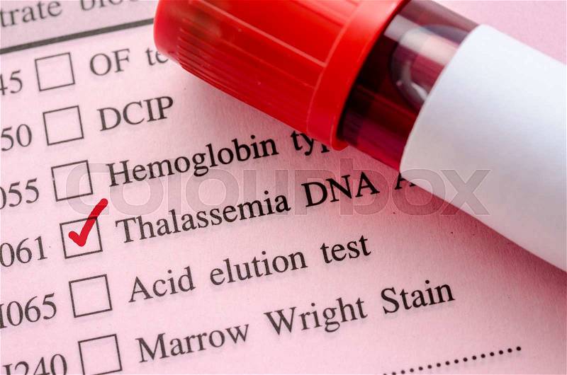 Sample blood in blood tube for Thalassemia DNA test on request form in laboratory, stock photo