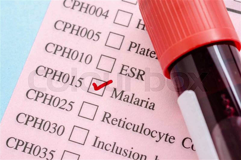 Sample blood tube on Malaria test form paper in laboratory, stock photo