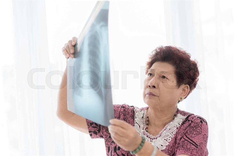 Asian senior woman looking at x-ray with window light, stock photo