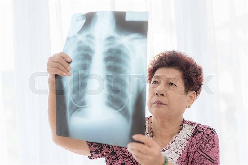 Asian senior woman looking at x-ray with window light, stock photo