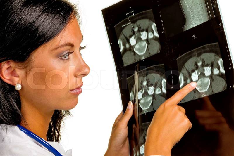 A doctor holding the x-ray image of a disc infiltration in hand, stock photo