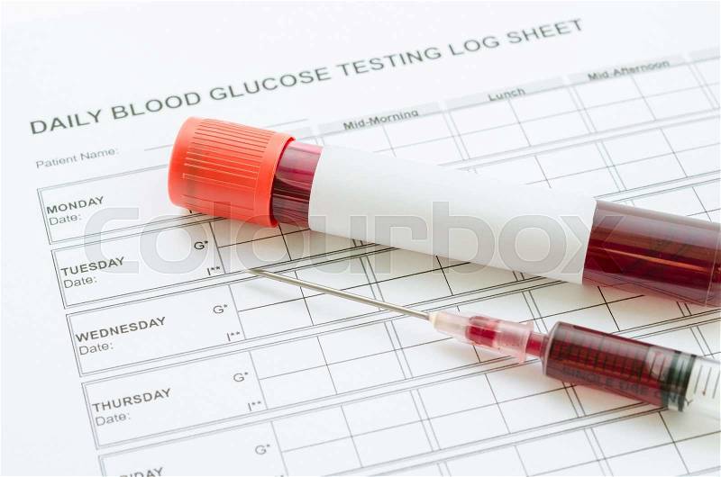 Daily blood glucose testing and sample blood in tube and syringe. Blood sugar control concept, stock photo