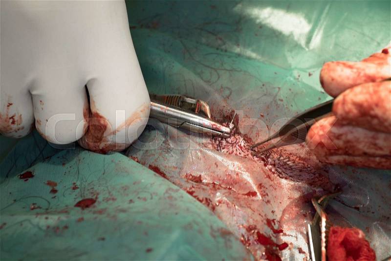 Closing the wound after surgery of a dog by a veterinary surgeon, stock photo