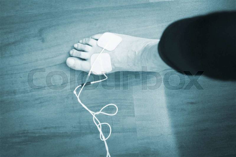 Patient foot, leg and ankle in electro physiotherapy electrical impulse stimulation rehabiliation treatment from injury in hospital clinic with electrical stimulus attached with plaster. , stock photo