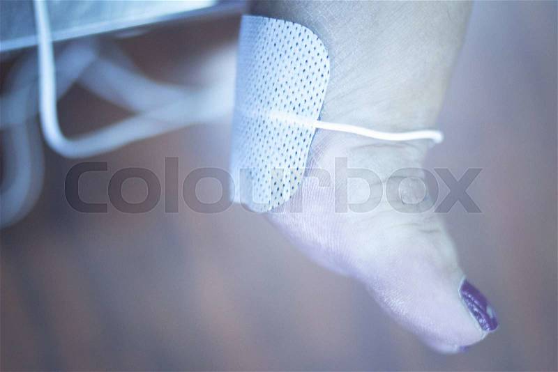 Patient foot, leg and ankle in electro physiotherapy electrical impulse stimulation rehabiliation treatment from injury in hospital clinic with electrical stimulus attached with plaster. , stock photo