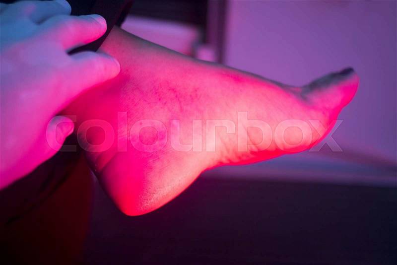 Patient foot in red physiotherapy heat treatment under hot light, stock photo