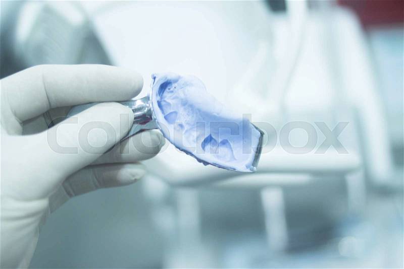 Dental mold dentist clay teeth plate gel gum colored cast model showing tooth decay and gum disease of patient in dental clinic office surgery used for diagnosis and treatment, stock photo