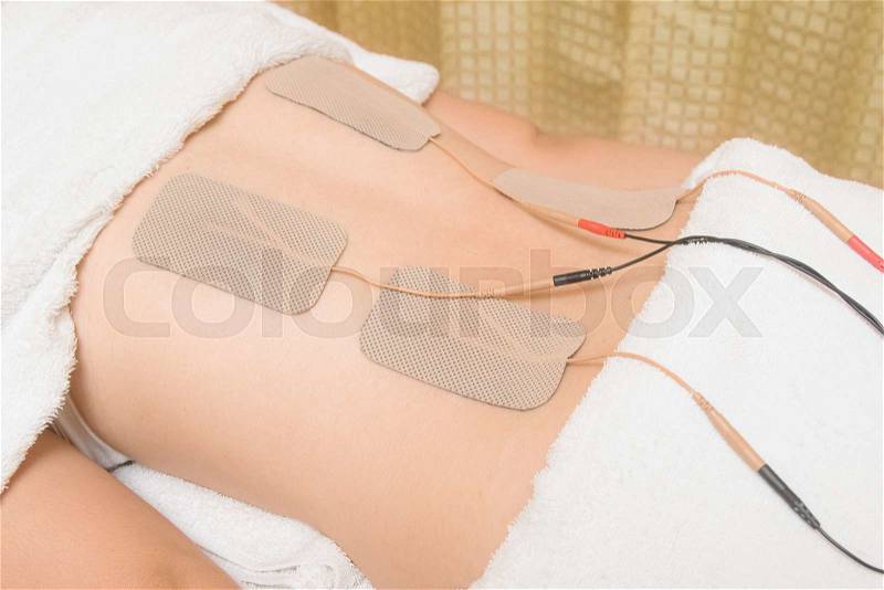 TENs therapy, Electrodes of tens device on back muscle, stock photo