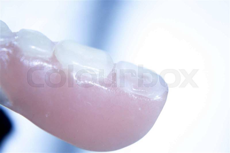 Removable partial denture metal and plastic dental false teeth prosthetic, stock photo