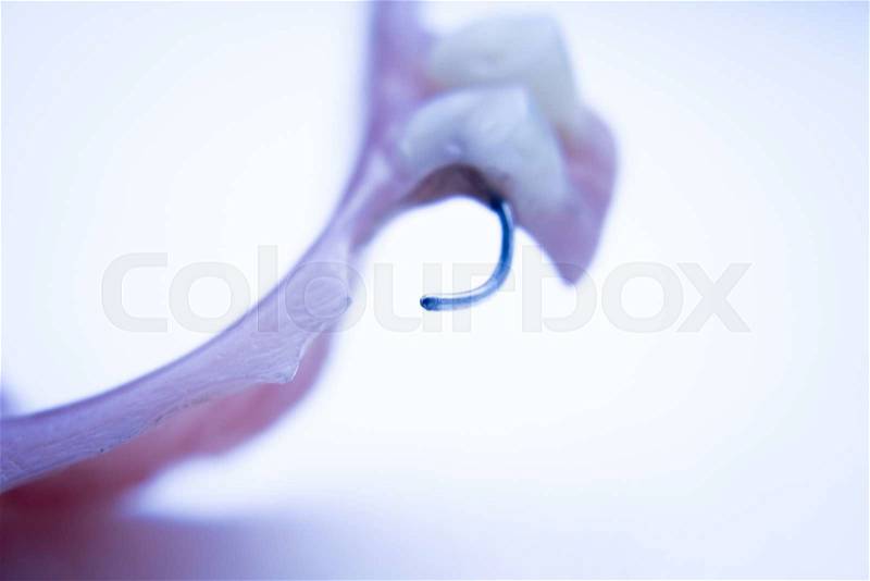 Removable partial denture metal and plastic dental false teeth prosthetic, stock photo