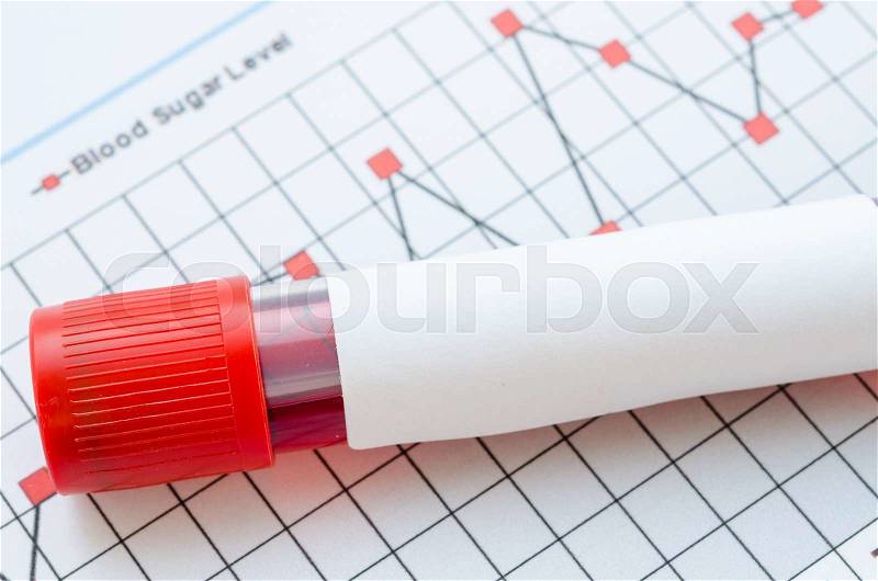 Daily blood glucose testing and sample blood in tube and syringe. Blood sugar control concept, stock photo