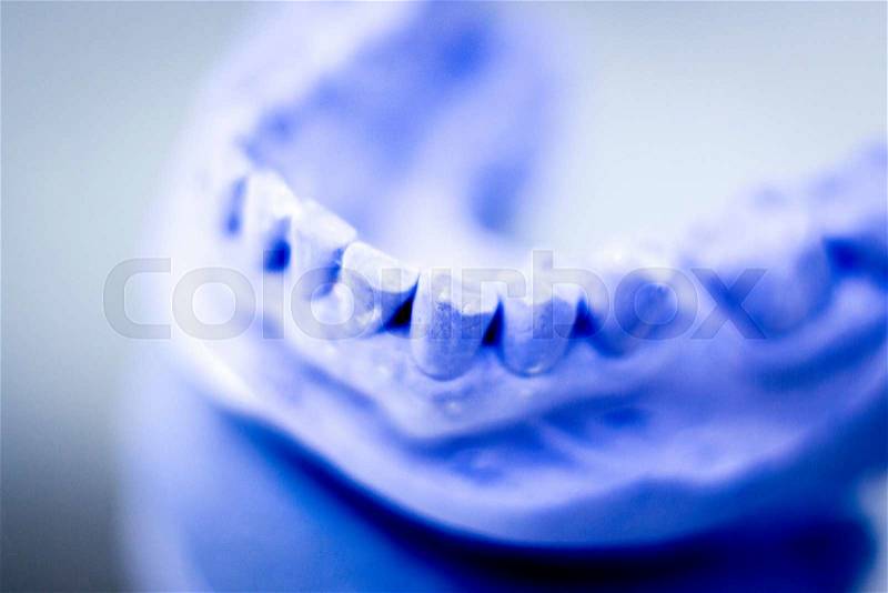 Dental prosthetics clay tooth mold in dentists photo, stock photo