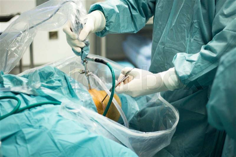 Knee arthroscopy orthopedic surgery operation in hospital emergency operating room photo, stock photo