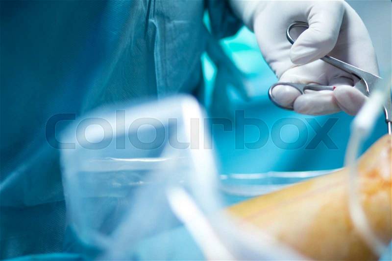Orthopedics knee surgery Traumatology hospital surgical operation photo, stock photo