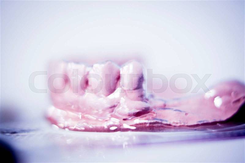 Dental prosthetics clay tooth mold in dentists photo, stock photo