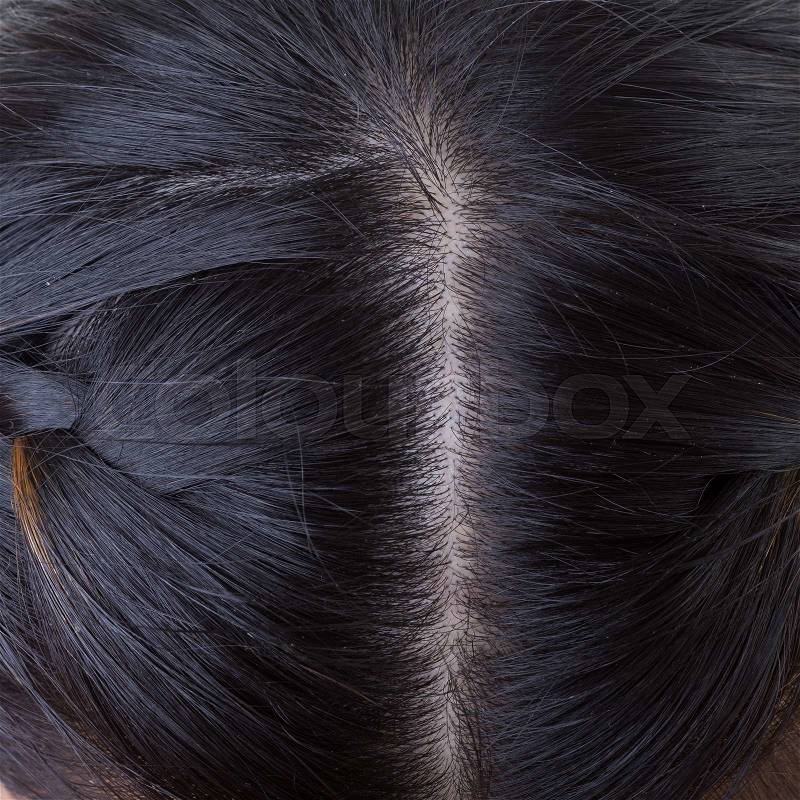 Black hair with dandruff on head, close-up image, stock photo