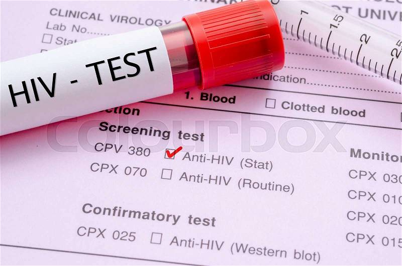 Sample blood collection tube with HIV test label on HIV infection screening test form, stock photo