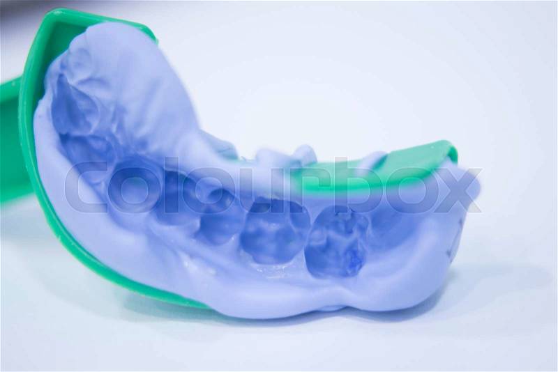 Dental mold dental impression plate in dentist\'s clinic, stock photo