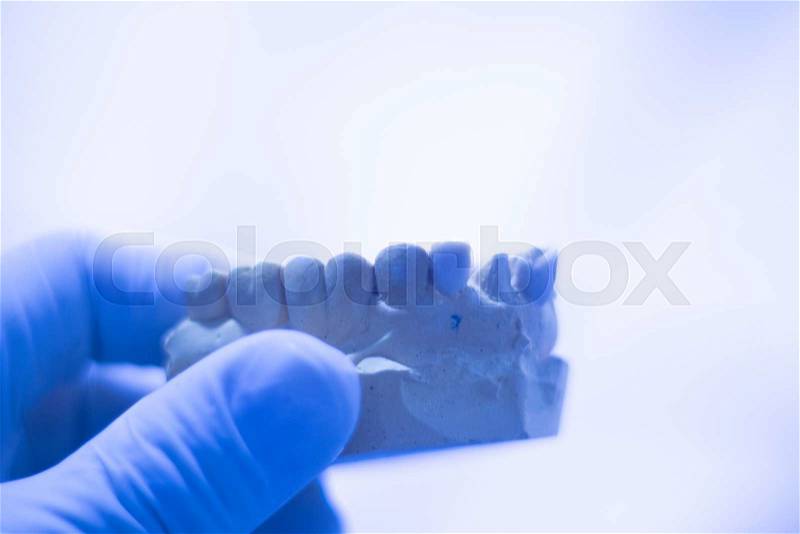 Dentists\' dental teeth prosthetic mould in clinic, stock photo